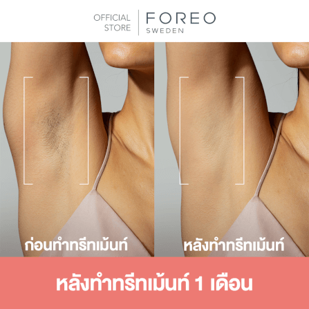 เครื่องกำจัดขน IPL FOREO PEACH2 Peach color_5